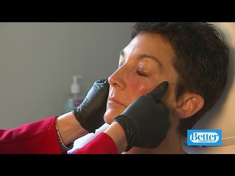 Using stem cells to rejuvenate skin