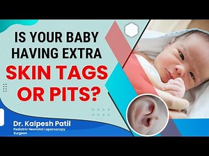 Is Your Baby Having Extra Skin Tags Or Pits In Front Of The External Ear | Dr. Kalpesh Patil