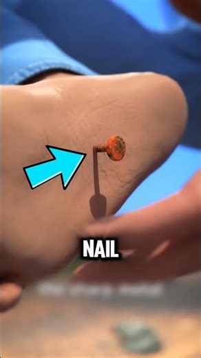 If Ever You Step On A Rusty Nail, Don't Do This!😱🦶#shorts