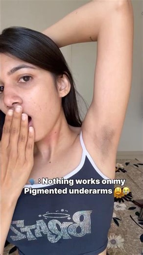 This is how I get rid of my underarm pigmentation 😱😍 #underarm #underarmpigmentation #pigmentation