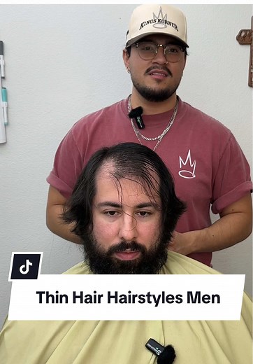 Transforming Thin Hair: Best Hairstyles for Men