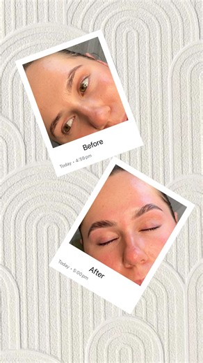 SYDNEY PHIBROW MICROBLADING | LASH & BROW STUDIO on Instagram: "Brow Lami transformation! 🔥 Book yours via the link in the bio! 📍Shop 5 / 108 maroubra road, Maroubra #BrowLamiSydney #BestBrowsSydney #SLB"