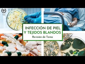 Infecciones de Piel y Tejidos Blandos - IMIG UEB