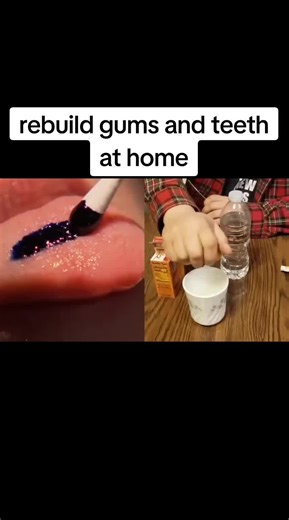 Regrow Gums & Teeth at Home: Natural Solution Revealed