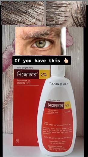 How to Use Ketoconazole for Face, Body, and Scalp