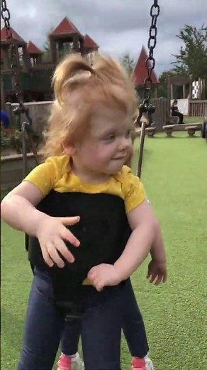 Conjoined twins, 19 months after separation