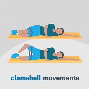 If you sit at a desk all day, you may experience vague discomfort and pain where you sit. Doctors may call this lower cross syndrome, gluteal amnesia or gluteus medius tendinosis. But another more memorable term is: “dead butt” syndrome. The job of the gluteus medius is to stabilize your hips and pelvis. When it’s weak and can’t function properly, you may experience varying levels of hip and lower back pain when you sit and sometimes when you move. Muscle weakness can also compress, pull or pinc