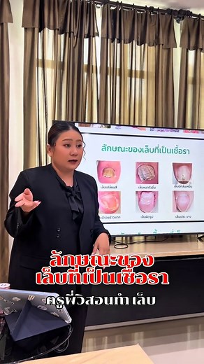 ลักษณะของเล็บที่เป็นเชื้อราและการทำเล็บ