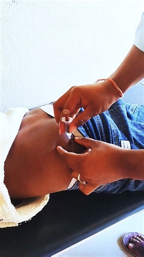 Pulling the ingection intramascullar 🥰💉 #intertainment #viral #doctorstrange