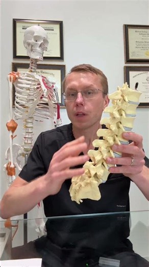 Damaged Discs and Pinched Nerves Explained #backpain #treatment