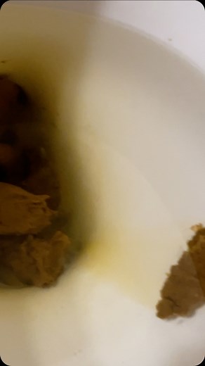 The Shit Showcase! | #poo #poop #funny #poopy #poopie #pooop #poops #poopsie #crap #crappy #craps #crappie #shit #shitty #shitton #shitpost #shitposting... | Instagram