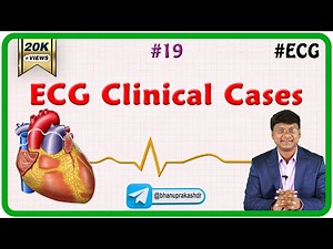 19. ECG Clinical cases
