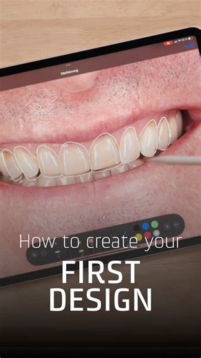 2D Smile Designs in SMILECLOUD