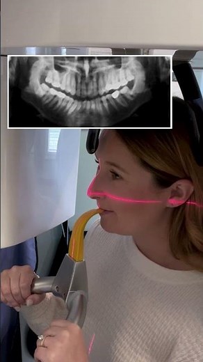 CBCT Pro Tip: Proper Patient Positioning