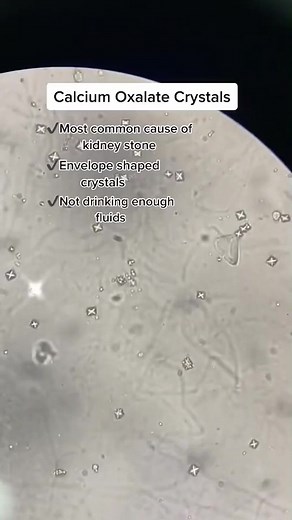 14K views · 223 reactions | Urine sample  #LabLife #microbiology | Lab life | Facebook