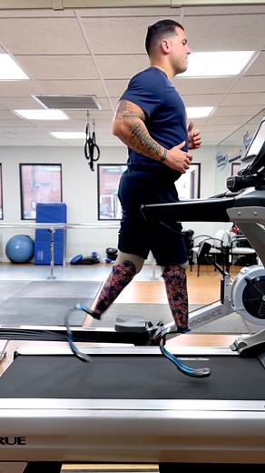 Wow, Matias, a bilateral below-knee amputee testing his new running blades on the treadmill. 🦿🏃🦾✨ #prosthetics #adaptive #runningmotivation #belowkneeamputee #limbdifference | A Step Ahead Prosthetics