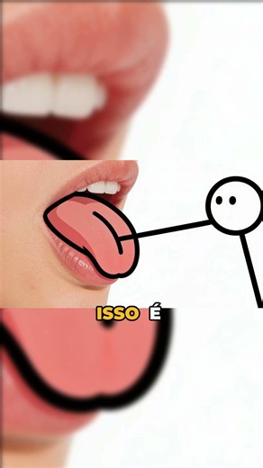 Língua presa não é só problema de bebê
