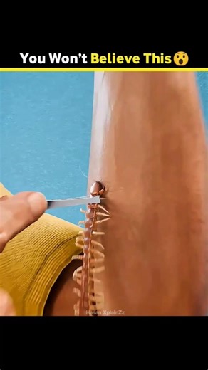 He Let Insects Sting Him to Measure Pain, And Created a Pain Scale... #shortsvideo