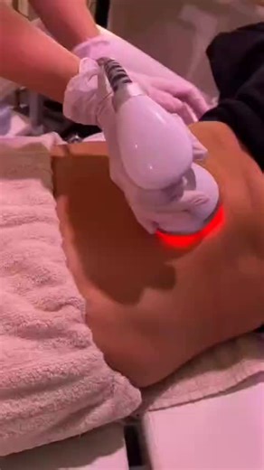 Sculpt Your Body, No Surgery Needed Break down stubborn fat, tighten skin, and contour your body with non-invasive body cavitation. Visible results, no downtime. DM now to book your session. #BodyCavitation #FatLoss #NonSurgical #BodySculpting #SkinTightening #WeightLossJourney #BodyContouring #SlimmingTreatment #ConfidenceBoost #BeautyTreatment #AestheticBody #FatReduction #TonedBody #GlowUp #SelfCare #HealthyLifestyle #WellnessJourney #NonInvasiveTreatment #ShapeYourBody #BookNow