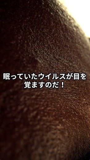 帯状疱疹はなぜ発症するのか 人にうつるのか ずんだもんと学びましょう #shorts #帯状疱疹 #ずんだもん #皮膚科