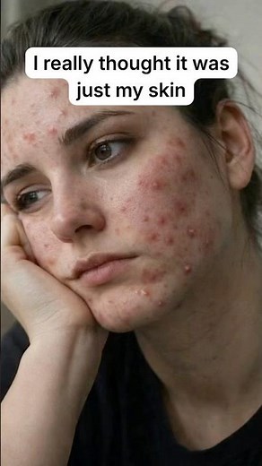 I thought it was just my skin... until I checked this