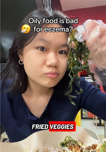 Managing Eczema: The Truth About Oily Foods