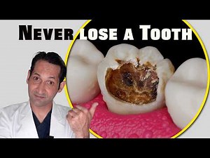 Master Dentist Showing Root Canal And Crown Treatment ! Lifetime Learning For Your Teeth