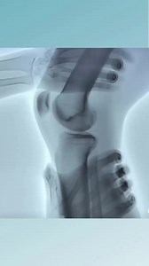 5.8K views · 86 reactions | 朗 ¡Mira este increíble vídeo del test de...