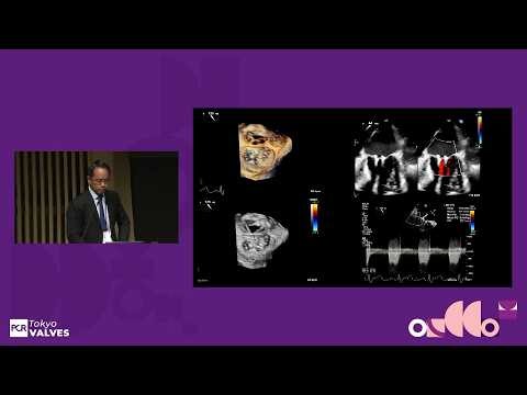 Mastering mitral TEER: guidelines, complex cases, and Asia Pacific insights - PCR Tokyo Valves 2026