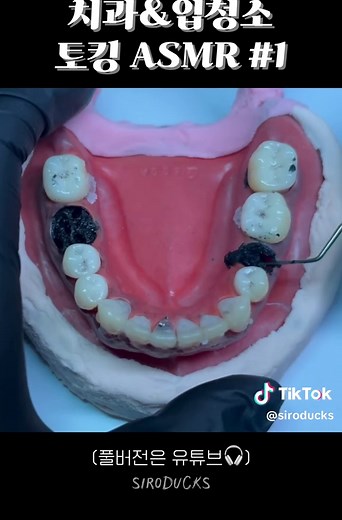 충치제거와 치석제거 ASMR 입청소 영상