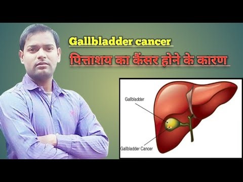 Gallbladder cancer causes । पित्ताशय का कैंसर होने के कारण ।