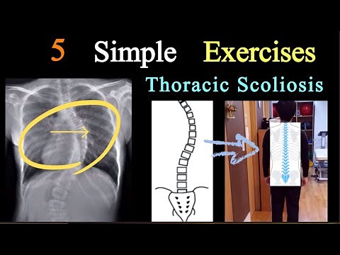 Thoracic Scoliosis (Right Side) | 5 simple exercises | Upper Back Right Curved Spine.
