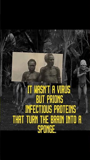 The Disease That Made People Laugh to Death 💀