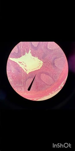Guess the slide#histology of appendix#identification points