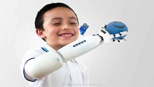 IKO: La prótesis de brazo compatible con piezas LEGO