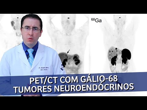 PET Scan com Gálio-68 para Tumores Neuroendócrinos | IMEB
