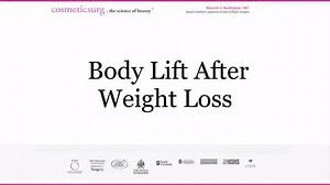 Learn Why a Body Lift Is an Ideal Procedure After Weight Loss