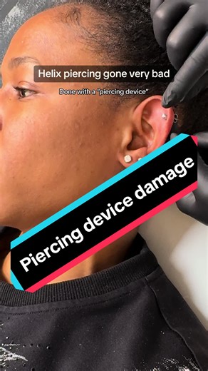 Helix Piercing Gone Wrong: Why Piercing Guns Are Bad