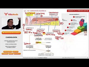 Cardiopatía Isquémica 1/5 2025: Diagnóstico y Manejo Actualizado | VILLAMEDIC