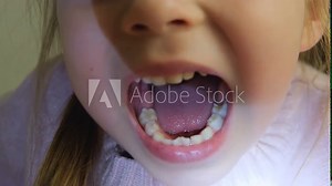 Child shows teeth and palate to the doctor. Health concept.