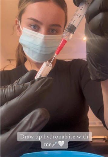 Hyaluronidase Preparation for Lip Filler Dissolve