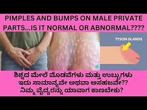 Pimples, White Spots, Bumps , Yellow Spots, Rashes on the male private parts it normal?