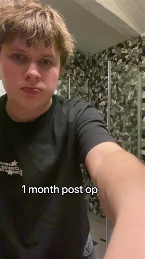 1 Month Post Op: Swelling Reduction in FTM Transition
