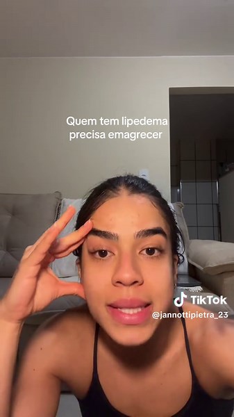 Lipedema: Dicas para Emagrecimento e Tratamento