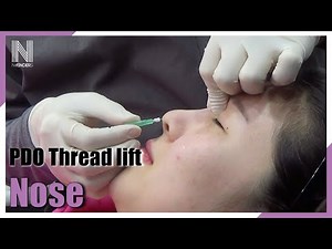 Nose Thread Lift | Y-KO