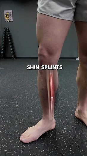 Shin Splints? Flat Foot? Walking or Running Wrong?