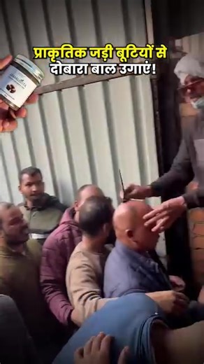 1.3K views | Tired of hair fall & thinning hair? Discover India’s trusted hair regrowth formula made with powerful Ayurvedic herbs. Visible results in 30 days. 100% safe, non-sticky, and easy to use. ✅ Stops Hair Fall ✅ Regrows New Hair ✅ Boosts Scalp Health Trusted by 50,000+ Indians. Tap below to order with FREE delivery | Jpwels | Facebook