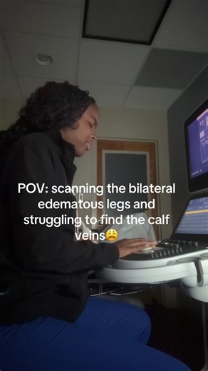 Struggling to Scan Edematous Legs During Ultrasound