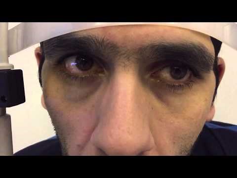 Macrosaccadic oscillations