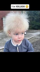 24K views · 230 reactions | The Rarest Human Genetics  #fblifestyle #interesting #genetics | Easy PodCast | Facebook